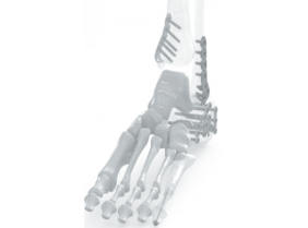 Chấn thương bàn chân và gót chân